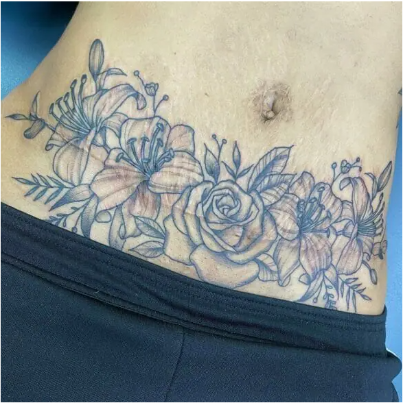 Flower Tummy Tuck Tattoos