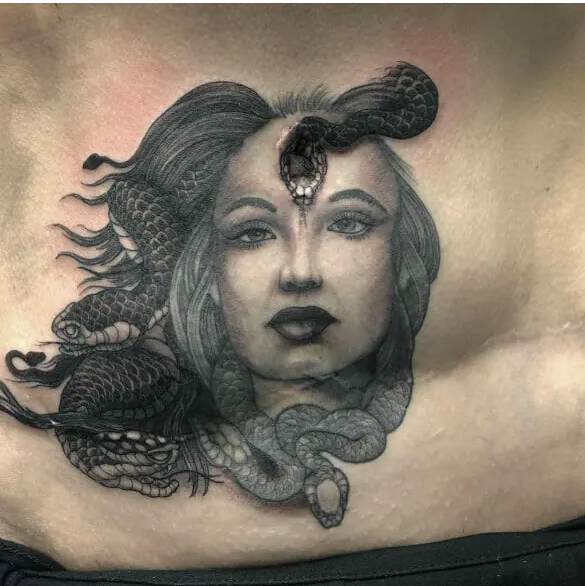 Medusa Themed Tummy Tuck Tattoo