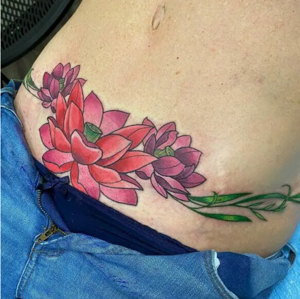 image9 News Home Tummy Tuck Tattoo with Lotus Flower