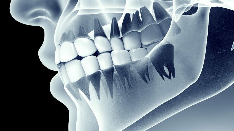 Are teeth made of bones?