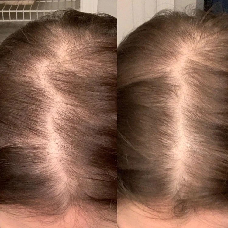 Nutrafol Review News Home Nutrafol Review