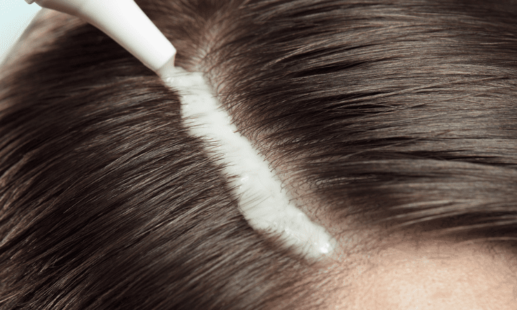 Scalp Exfoliation: Healthy Hair