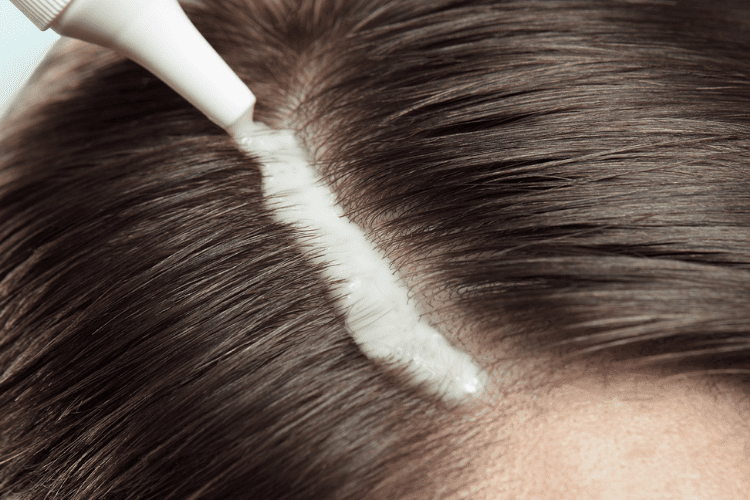 scalp exfoliation