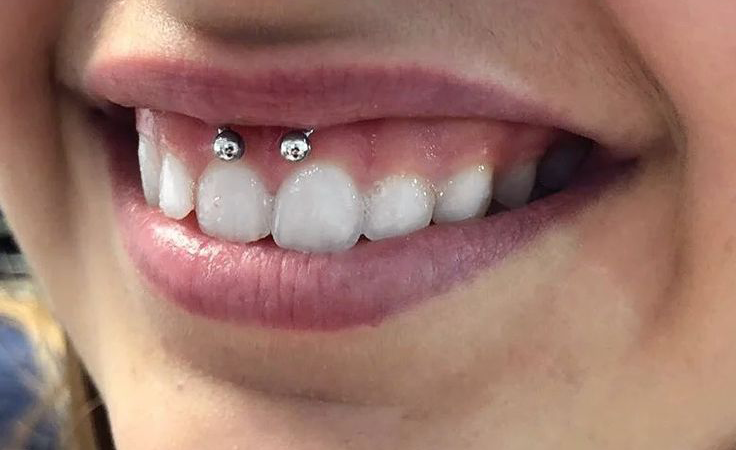 Smiley Piercing