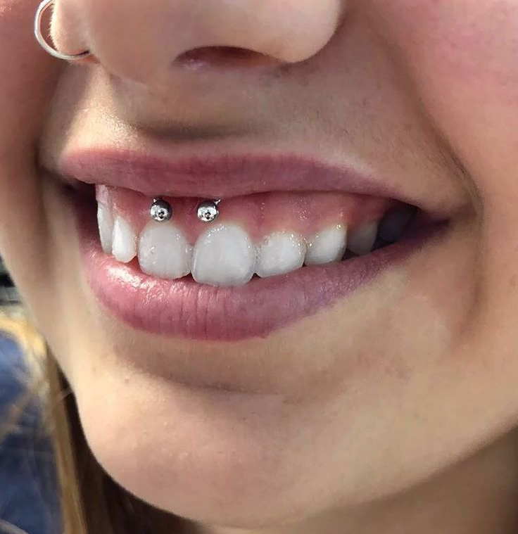 Smiley Piercing